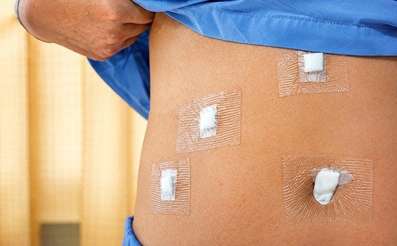 Recovery Tips After Gallbladder Cancer Treatment