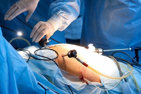 What Are the Risks or Complications of Gallbladder Cancer Treatment?