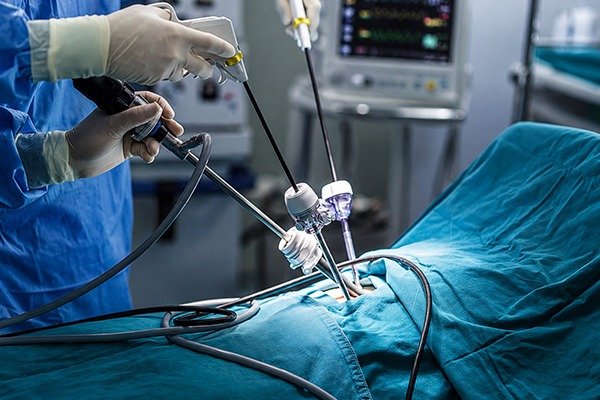 Gallbladder Cancer Treatment