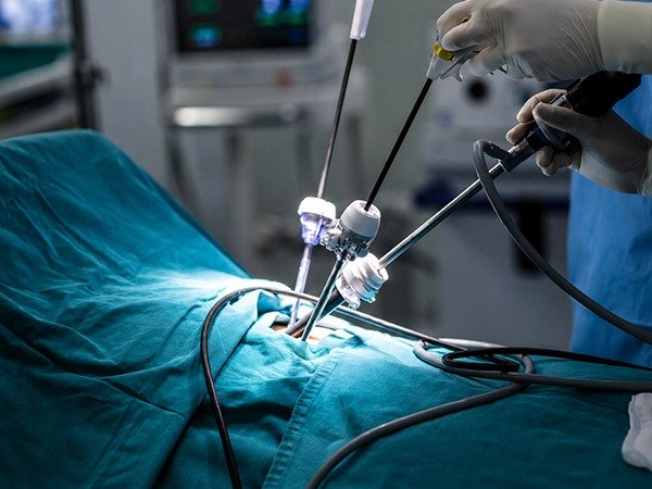 How to Prepare for Minimally Invasive GI Cancer Surgery?