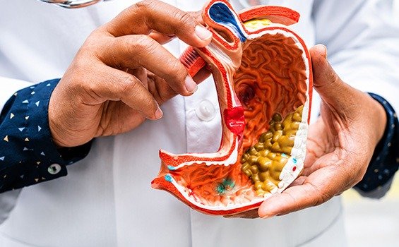 Recovery Tips After Minimally Invasive GI Cancer Surgery