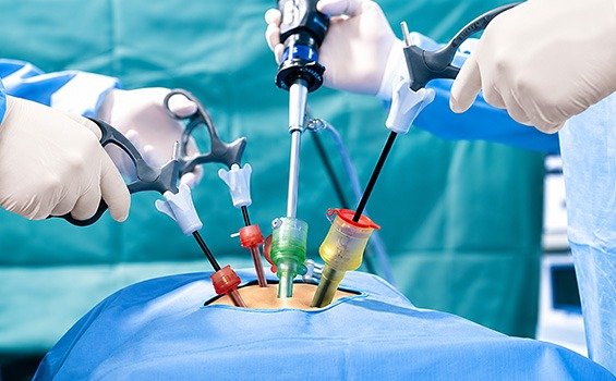 What Types of Neuroendocrine Tumours Can Be Treated with Surgery?