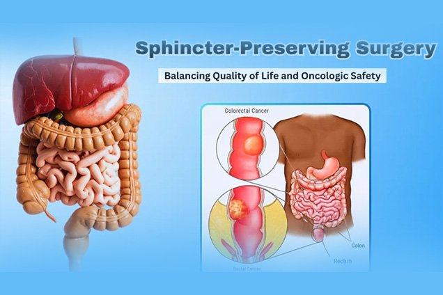 Sphincter Saving Surgical Procedure