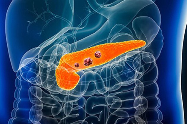 Risks & Complications