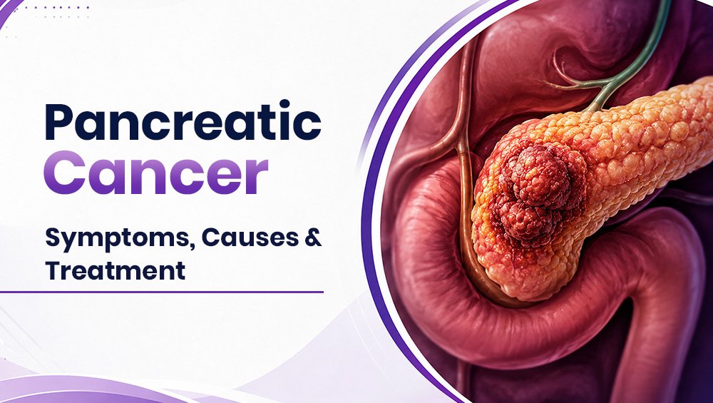 Pancreatic Cancer