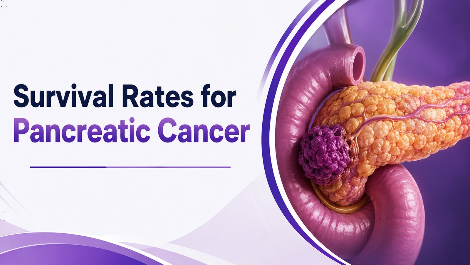 Survival Rates for Pancreatic Cancer