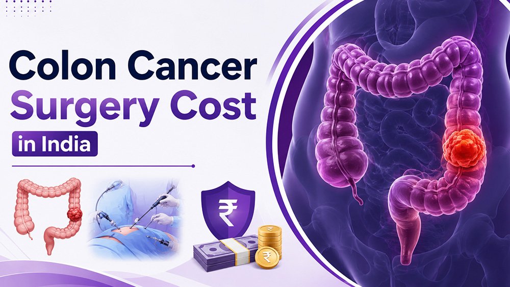 colon-cancer-surgery-cost-in-india