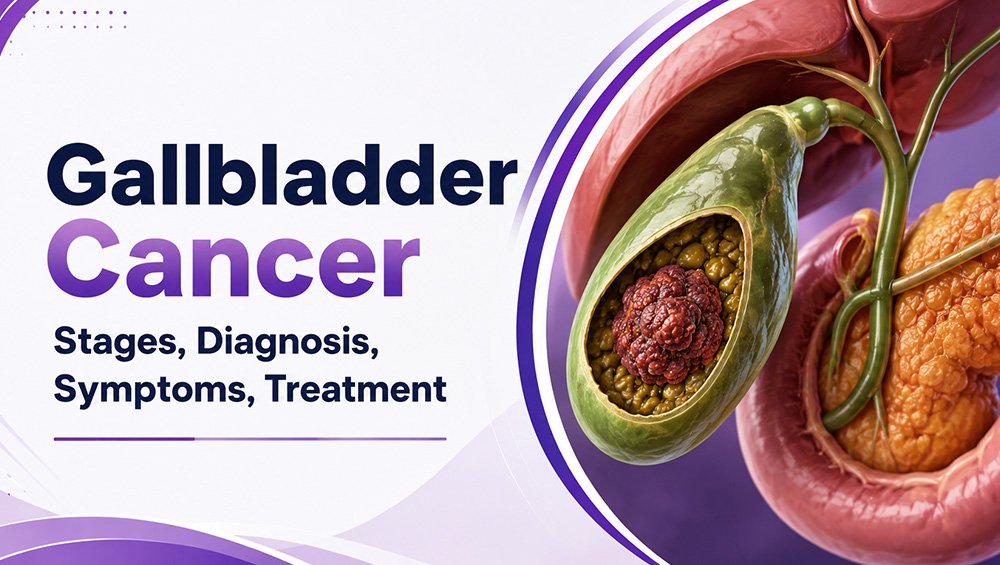 Gallbladder Cancer
